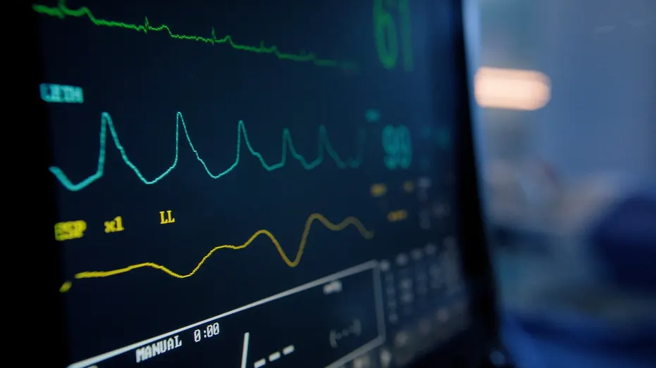 Moniteur de signes vitaux affichant la fréquence cardiaque et les lectures d'électrocardiogramme dans l'unité de soins intensifs de l'hôpital